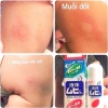 Bôi Muỗi Lăn Muhi Liquid 50ml - Giảm Ngứa Dịu Da, An Toàn Cho Trẻ và Người Lớn, Giá 114k 3