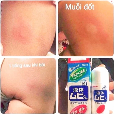 Bôi Muỗi Lăn Muhi Liquid 50ml - Giảm Ngứa Dịu Da, An Toàn Cho Trẻ và Người Lớn, Giá 114k