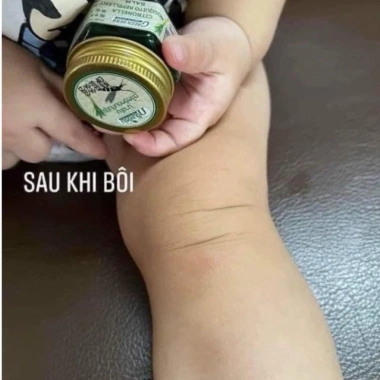 Cao bôi muỗi đốt côn trùng Green Herb Citronella Thái Lan 20gr - 39.900 VND 4
