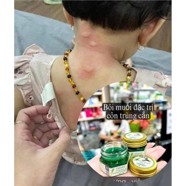 Cao bôi muỗi đốt côn trùng Thái Lan 20g/30g Green Herb - Chống muỗi giảm giá 45k 5