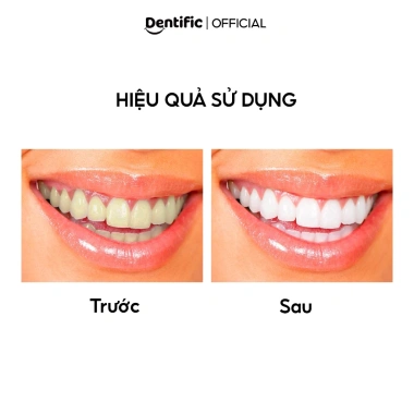 Combo 2 kem đánh răng than hoạt tính Dentific Bright Me Smile - Sáng răng, sạch mảng bám, 100g - 164.000₫ 4