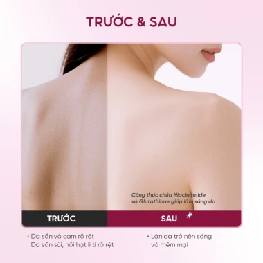 Combo 3in1 Grace&Glow: Sữa tắm, Lăn khử mùi, Body Mist - Trắng da, Dưỡng ẩm, Giá 321.000đ 2 Combo 3in1 Grace&Glow: Sữa tắm, Lăn khử mùi, Body Mist - Trắng da, Dưỡng ẩm, Giá 321.000đ 2