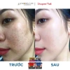 Combo Meiduzi mờ nám tàn nhang Nhật - kem ngày đêm + serum DC120 cấp ẩm - 135k 2