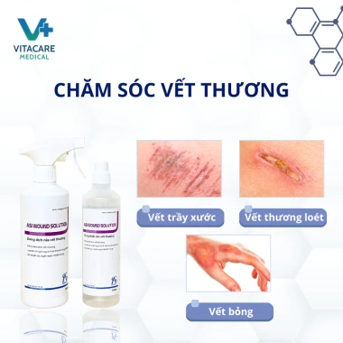Combo Vệ Sinh Vết Thương Asiwound 350ml + Bộ Chăm Sóc Thời Thanh Bình - Giá Ưu Đãi 173.000 VND 3