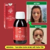 Dehema 100ml - Dung Dịch Uống Bảo Vệ Sức Khỏe, Giảm Sưng Bầm Tím Nhanh Chóng Herbal House 2