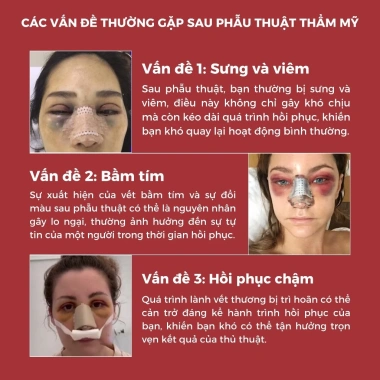 Dehema 100ml - Dung Dịch Uống Bảo Vệ Sức Khỏe, Giảm Sưng Bầm Tím Nhanh Chóng Herbal House 3