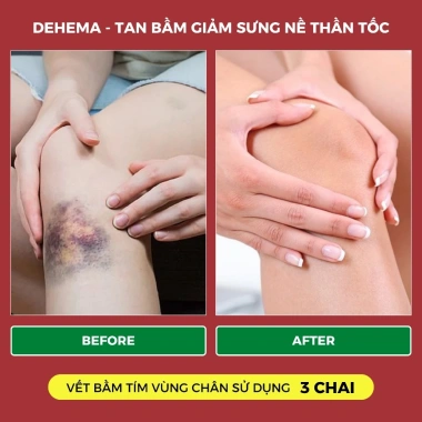 Dehema 100ml - Dung Dịch Uống Bảo Vệ Sức Khỏe, Giảm Sưng Bầm Tím Nhanh Chóng Herbal House 9