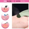 Dụng cụ lột mụn đầu đen, cây đẩy mụn, tẩy tế bào chết mặt - chỉ 18.000 VND 6