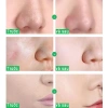 Gel tẩy tế bào chết mặt trắng da nha đam - Dưỡng ẩm, giảm mụn, da dầu, da sạch 130k 2