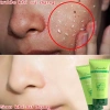 Gel tẩy tế bào chết mặt trắng da nha đam - Dưỡng ẩm, giảm mụn, da dầu, da sạch 130k 3