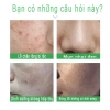Gel tẩy tế bào chết mặt trắng da nha đam - Dưỡng ẩm, giảm mụn, da dầu, da sạch 130k 4