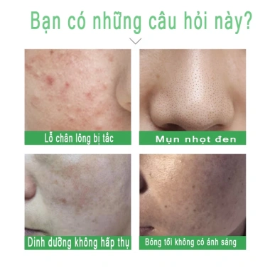 Gel tẩy tế bào chết mặt trắng da nha đam - Dưỡng ẩm, giảm mụn, da dầu, da sạch 130k 4