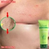Gel tẩy tế bào chết mặt trắng da nha đam - Dưỡng ẩm, giảm mụn, da dầu, da sạch 130k 5