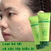 Gel tẩy tế bào chết mặt trắng da nha đam - Dưỡng ẩm, giảm mụn, da dầu, da sạch 130k 7