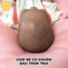 Gối chữ U cho bé sơ sinh: Chống giật mình, ngăn méo đầu, giảm giá 20% 3
