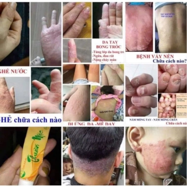 Kem bôi da Thuần Mộc Thanh Mộc Hương 16g - Dưỡng ẩm sâu, giảm ngứa, chính hãng, giá 112.000đ