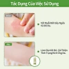 Kem Bôi Muỗi Đốt RUNBEN - Giảm Ngứa, An Toàn Lành Tính Cho Bé, Giá 175.000 VND 3