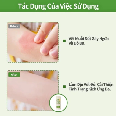 Kem Bôi Muỗi Đốt RUNBEN - Giảm Ngứa, An Toàn Lành Tính Cho Bé, Giá 175.000 VND 3