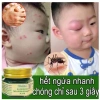 Kem Bôi Muỗi Đốt THÁI LAN Cao Cấp Giảm Sưng Ngứa, Dịu Vết Đốt, Kiến Cắn 75.000 7