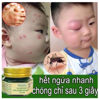 Kem Bôi Muỗi Đốt THÁI LAN Cao Cấp Giảm Sưng Ngứa, Dịu Vết Đốt, Kiến Cắn 75.000 7 Kem Bôi Muỗi Đốt THÁI LAN Cao Cấp Giảm Sưng Ngứa, Dịu Vết Đốt, Kiến Cắn 75.000 7