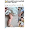 Kem Bôi Muỗi Quốc Dân Hàn Quốc Giảm Ngứa, Chống Viêm, Dịu Da Nhanh - 189.000 VND 8