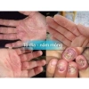Kem bôi nấm da đầu hắc lào, giảm ngứa, ngừa vẩy nến, hỗ trợ chân tay - chỉ 39.000đ 3