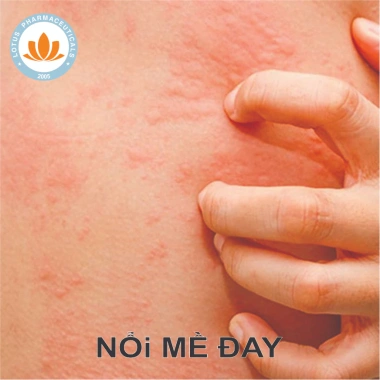 Kem bôi ngoài da Promethazin 10g - Giảm giá 16.100₫, giảm ngứa, làm dịu da