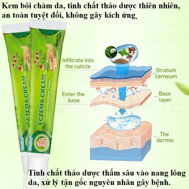 Kem Bôi Ngứa, Eczema, Chàm Da, Mụn Nước, Tổ Đỉa - Thảo Dược An Toàn, Hiệu Quả Tức Thì, Giá 110.880 VNĐ 5 Kem Bôi Ngứa, Eczema, Chàm Da, Mụn Nước, Tổ Đỉa - Thảo Dược An Toàn, Hiệu Quả Tức Thì, Giá 110.880 VNĐ 5