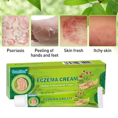 Kem Bôi Ngứa, Eczema, Chàm Da, Mụn Nước, Tổ Đỉa - Thảo Dược An Toàn, Hiệu Quả Tức Thì, Giá 110.880 VNĐ