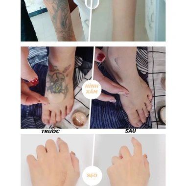 Kem che hình xăm Love in – Bỏ hình xăm hiệu quả, bền màu, không thấm nước, phù hợp mọi tone da – 99.000đ 7