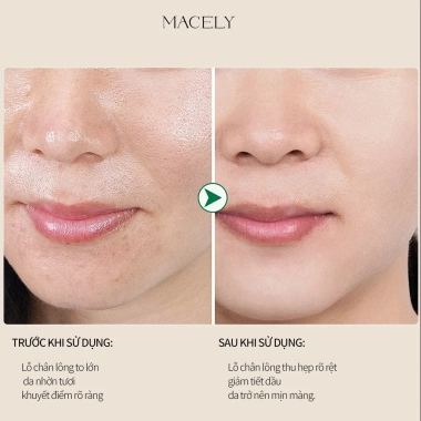 Kem Lót Kiềm Dầu Macely 2 trong 1 - Che Lỗ Chân Lông, Kiểm Soát Dầu, Làm Sáng Da 30g