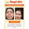 Kem Lười AVP VC 5in1 Nâng Tông Che Khuyết Điểm, Da Trắng Mịn, Dành Cho Người Bận Rộn - Giá 139.999 Đón Tết 4