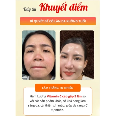 Kem Lười AVP VC 5in1 Nâng Tông Che Khuyết Điểm, Da Trắng Mịn, Dành Cho Người Bận Rộn - Giá 139.999 Đón Tết 4