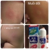 Lăn Bôi Muỗi Đốt & Côn Trùng Cắn Muhi Chim Cánh Cụt 50ml - Diệt Nhanh, Giá 90k 3