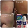 Lăn Bôi Muỗi Đốt và Côn Trùng Cắn 50ml - Kem Muhi Chim Cánh Cụt Giảm Giá 97k 2