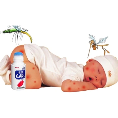 Lăn bôi muỗi muhi Nhật Bản 50ml - Xua đuổi muỗi, côn trùng cắn, giảm giá 100k