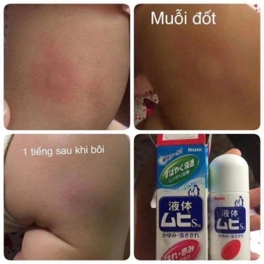 Lăn bôi muỗi Nhật Bản cho trẻ – Diệt muỗi, làm mát, giảm ngứa, an toàn 117.900₫ 3 Lăn bôi muỗi Nhật Bản cho trẻ – Diệt muỗi, làm mát, giảm ngứa, an toàn 117.900₫ 3