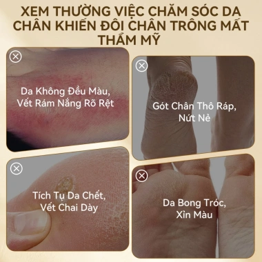 LANBENA Mặt Nạ Chân Dưỡng Da Lột Da Chết Spa - Ủ 15p Loại Bỏ Vết Chai, Giảm 22% 4