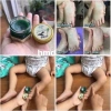 Lọ Cao Bôi Muỗi Đốt Côn Trùng 20gr Thái Lan - Diệt Muỗi, Không Kích Ứng, Giá 45.000 7