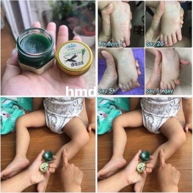 Lọ Cao Bôi Muỗi Đốt Côn Trùng 20gr Thái Lan - Diệt Muỗi, Không Kích Ứng, Giá 45.000 7
