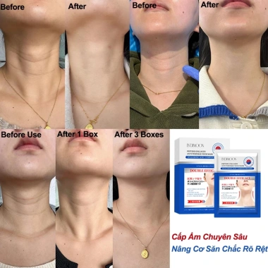 Mặt nạ cổ 10 miếng chống nhăn săn chắc cấp ẩm dưỡng trắng làm sáng da 148.000₫ 3 Mặt nạ cổ 10 miếng chống nhăn săn chắc cấp ẩm dưỡng trắng làm sáng da 148.000₫ 3