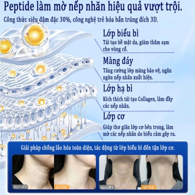 Mặt nạ cổ 10 miếng chống nhăn săn chắc cấp ẩm dưỡng trắng làm sáng da 148.000₫