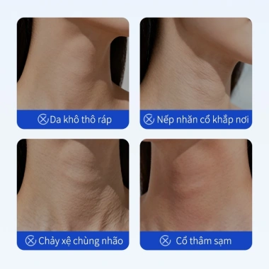 Mặt nạ cổ chống nhăn, săn chắc da, giảm nếp nhăn, dưỡng ẩm, làm sáng da - Giá ưu đãi 128.000 VND