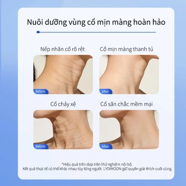 Mặt nạ cổ chống nhăn, săn chắc da, giảm nếp nhăn, dưỡng ẩm, làm sáng da - Giá ưu đãi 128.000 VND