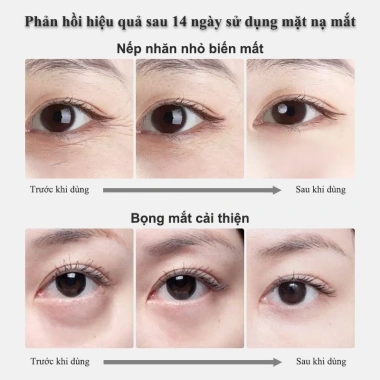 Mặt Nạ Mắt Chống Nếp Nhăn, Chống Thâm, Loại Bọng Mắt - 80 miếng Giữ Ẩm, Giá 118.000₫
