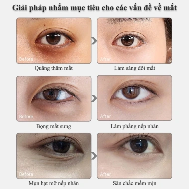 Mặt Nạ Mắt Chống Nếp Nhăn, Chống Thâm, Loại Bọng Mắt - 80 miếng Giữ Ẩm, Giá 118.000₫