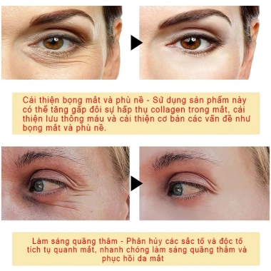 Mặt Nạ Mắt Collagen 60 Miếng Giảm Thâm Bọng & Nếp Nhăn, Chống Lão Hóa, Giá Ưu Đãi 138k 5 Mặt Nạ Mắt Collagen 60 Miếng Giảm Thâm Bọng & Nếp Nhăn, Chống Lão Hóa, Giá Ưu Đãi 138k 5
