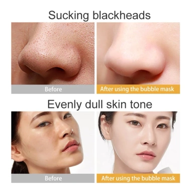 Mặt nạ sủi bọt thải độc muối biển đen JOMTAM - Dưỡng ẩm, trắng sáng da, chỉ 80.000₫
