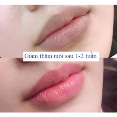 Mặt Nạ Tẩy Da Chết Môi Bubble Lip - Bỏ Keratin, Giảm Thâm, Dưỡng Mềm Mịn, Hồng Hào - 49.008 VND