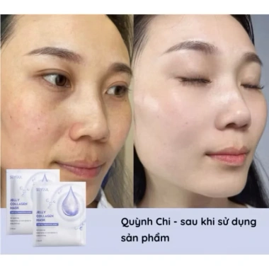 Mặt nạ thạch Collagen Seyoul Hàn Quốc - Dưỡng trắng, cấp ẩm, da căng, mịn, 5 miếng 80.000₫
